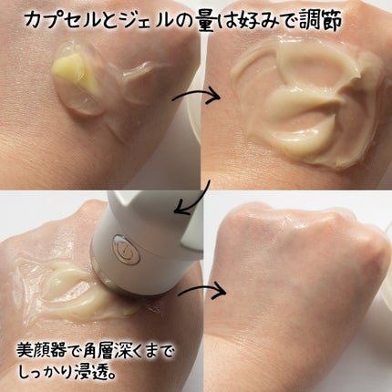 コスザッカ on LIPS 「\メガ割で狙え!夏までに垢抜ける美顔器付きブライトニングケアセ..」(5枚目)