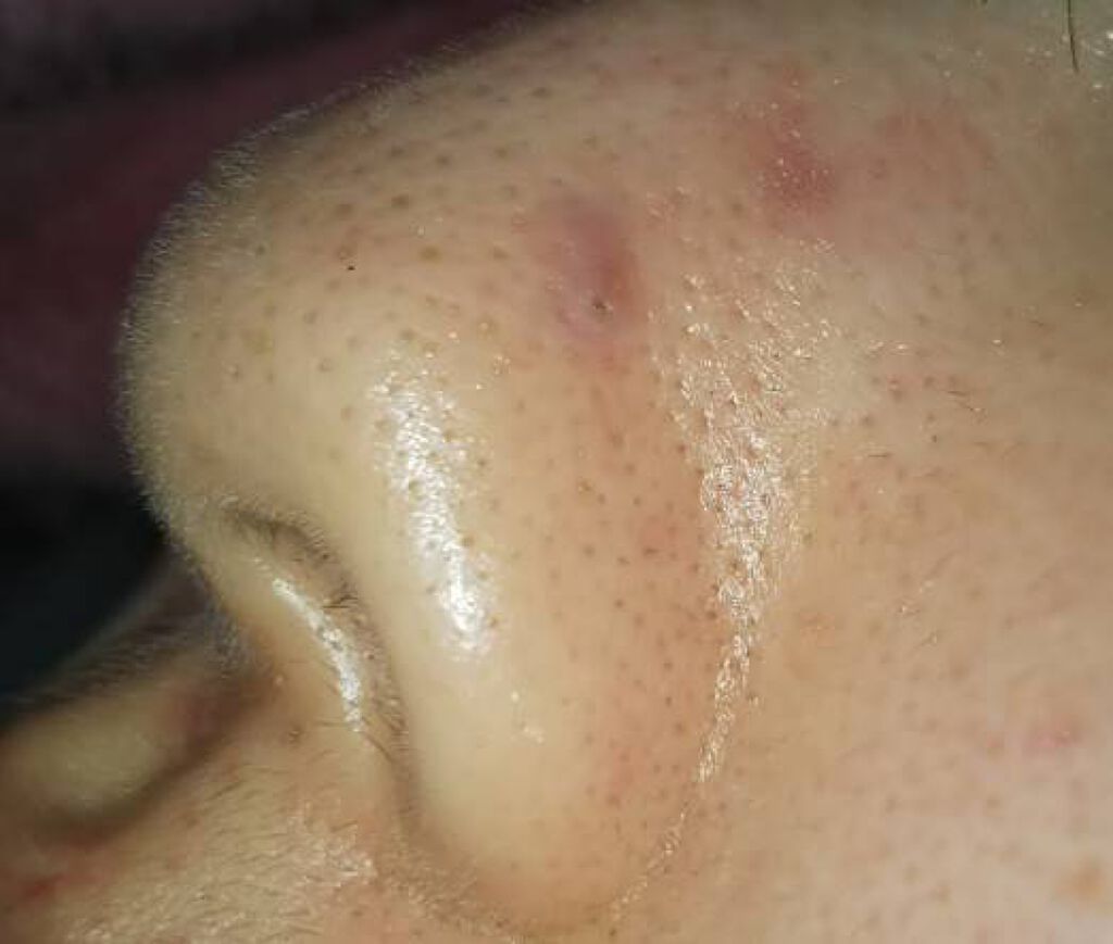 ロゼット洗顔パスタ 海泥スムース/ロゼット/洗顔フォームを使ったクチコミ(2枚目)