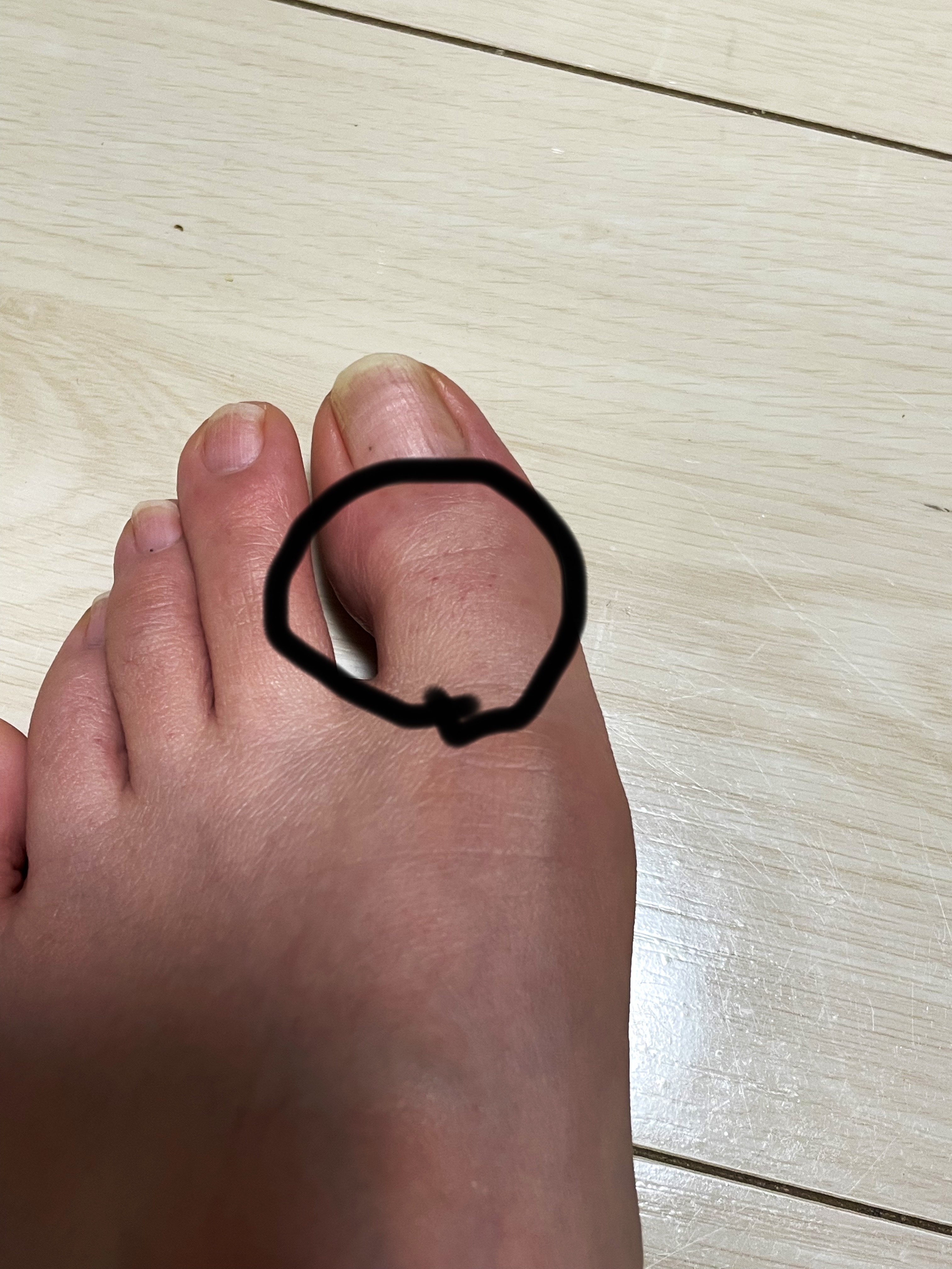 イージーパックDP60分タイプ 60分タイプ Sサイズ/ベビーフット/レッグ・フットケアを使ったクチコミ（3枚目）