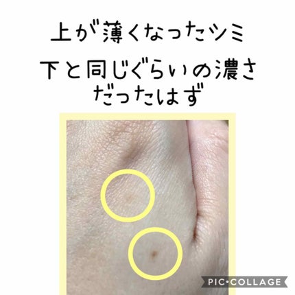 薬用 しみ 集中対策 美容液/メラノCC/美容液を使ったクチコミ(2枚目)