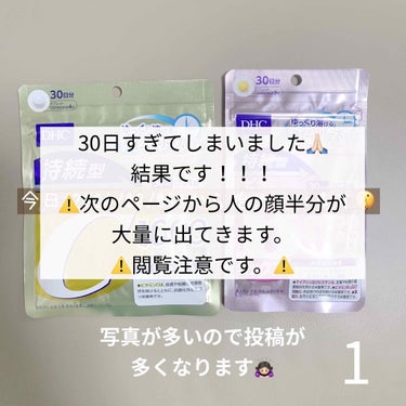 ニキビ撲滅のため30日間、
ビタミンCとビタミンBを飲み続け、水2Ｌを飲み、とその他もろもろ以前に投稿したものを続けてみた結果です！

写真が多くて全部1枚にまとめようとも考えたのですが、顔がいっぱい並