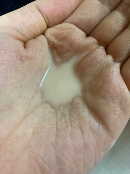 VC100エッセンスローション EX/ドクターシーラボⓇ/化粧水を使ったクチコミ(2枚目)