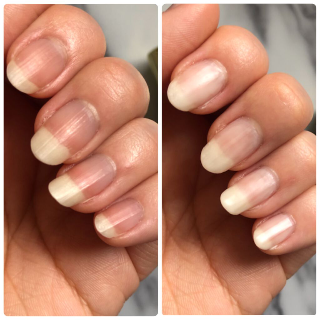 クイックスムージングベース/ネイリスト/ネイルベースコートを使ったクチコミ(4枚目)