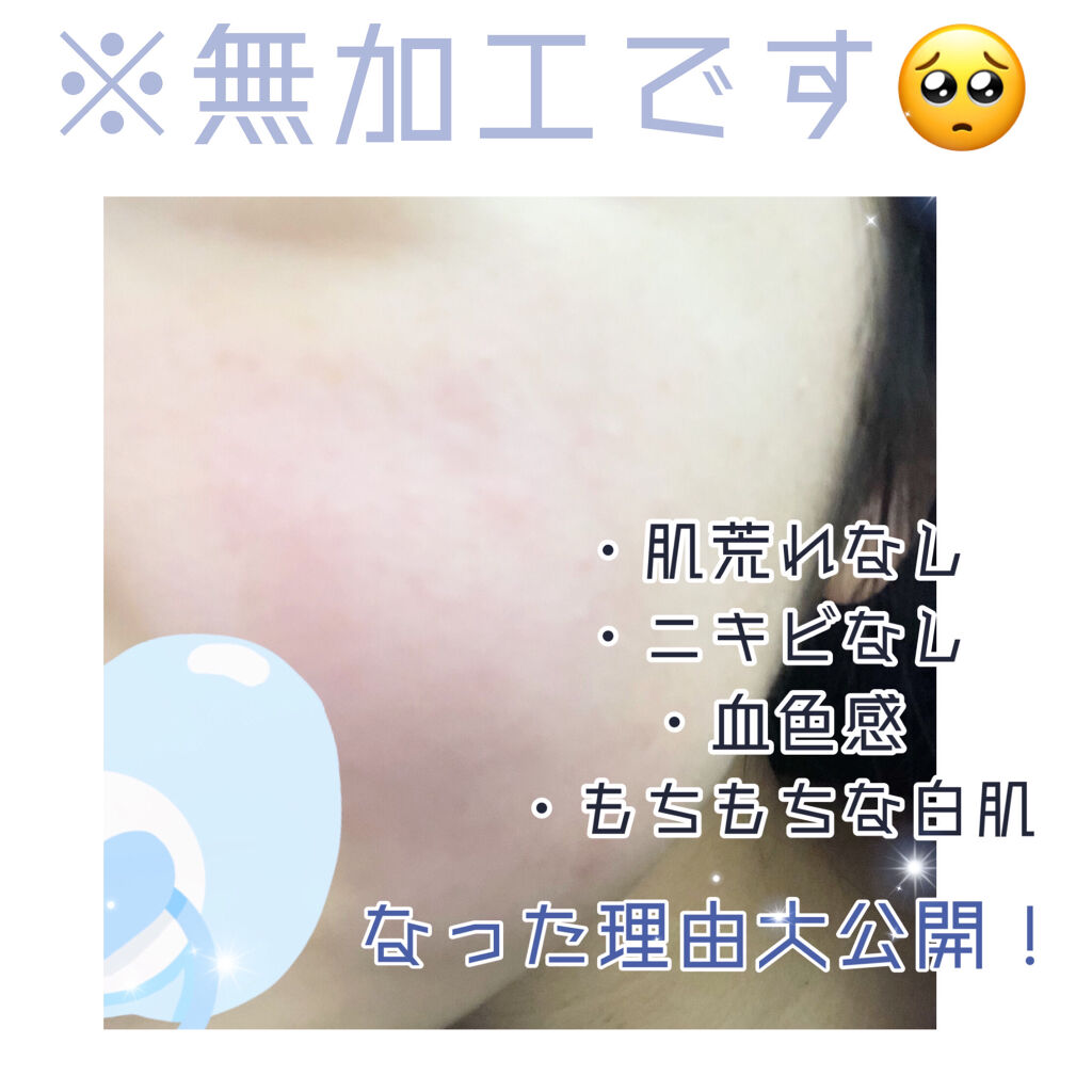 デリケートクリーム/エンビロン/フェイスクリームを使ったクチコミ（1枚目）