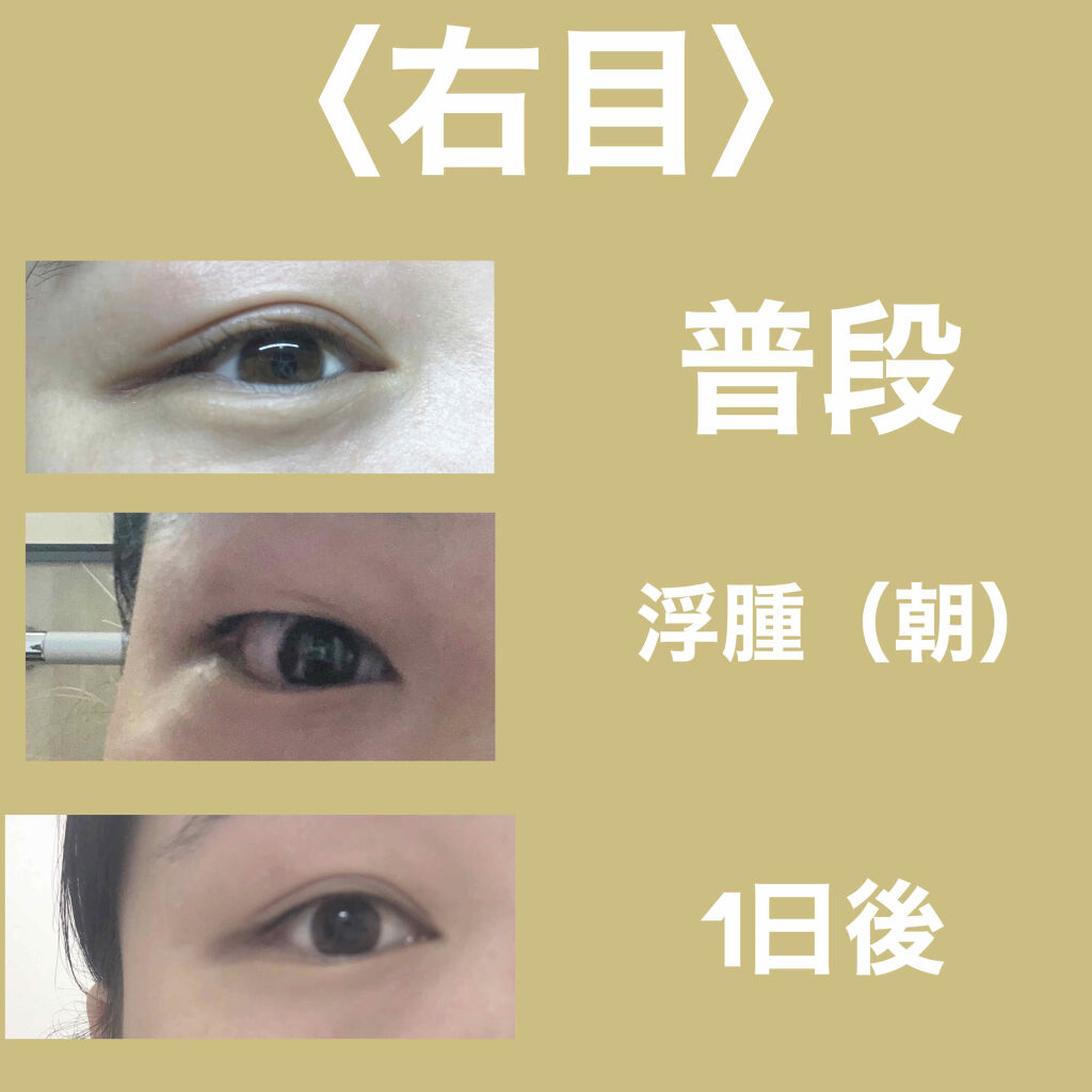 のびーるアイテープ（絆創膏タイプ、レギュラー）/DAISO/二重まぶた用アイテムを使ったクチコミ（2枚目）