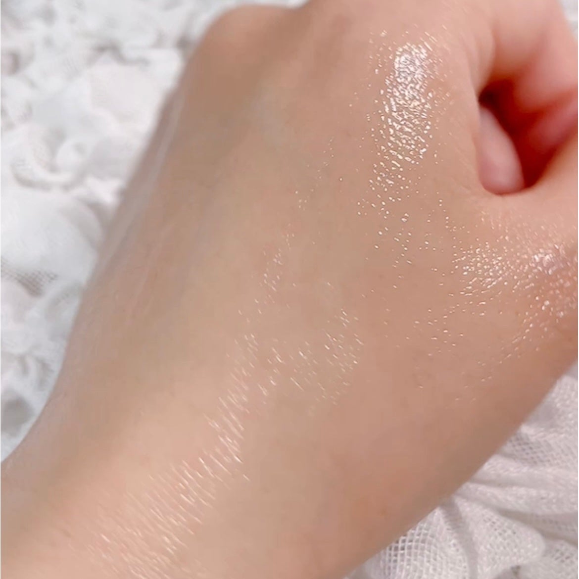 シカレチA エッセンス0.1/VT/美容液を使ったクチコミ(6枚目)