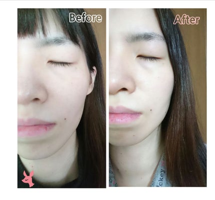 モイスチャライザーAGARISM/AGARISM/フェイスクリームを使ったクチコミ(4枚目)