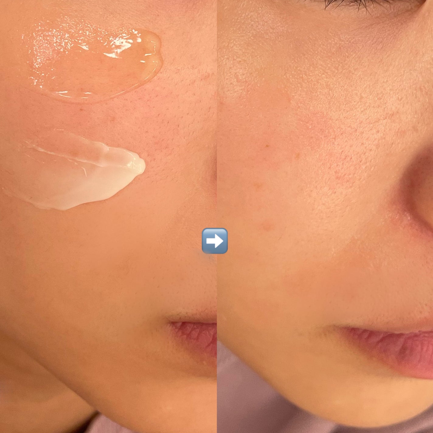 ホワイトトリュフダブルセラムアンドクリーム/ダルバ/フェイスクリームを使ったクチコミ(5枚目)