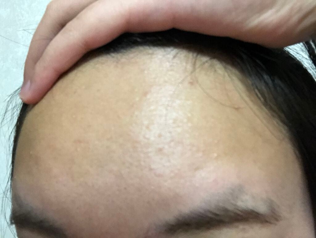 orange_beauty_3vmw on LIPS 「毛穴なくなる!と記載されていたものを沢山使用しましたが、一向に..」(3枚目)