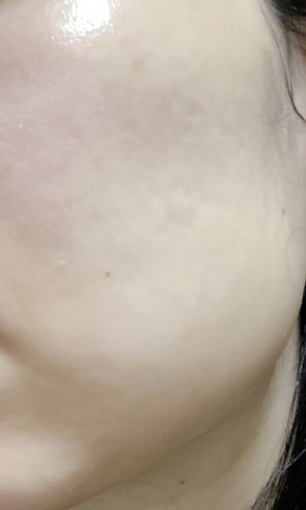 ネイチャーコンク 薬用クリアローション/ネイチャーコンク/拭き取り化粧水を使ったクチコミ(2枚目)