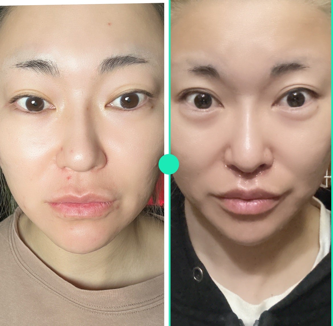 5児ママ ゆかこ♡フォロバ100 コメください on LIPS 「@haab_dream様のプロモーションに参加しています♡投稿..」(7枚目)