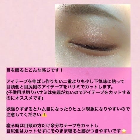 のびーるアイテープ(絆創膏タイプ、レギュラー)/DAISO/二重まぶた用アイテムを使ったクチコミ(3枚目)