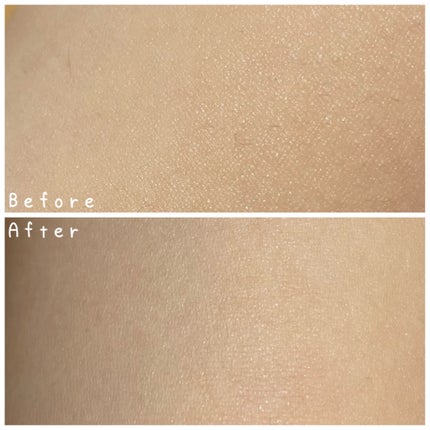 SIPL-1000C 家庭用光美容器/eosika/家庭用脱毛器を使ったクチコミ(4枚目)