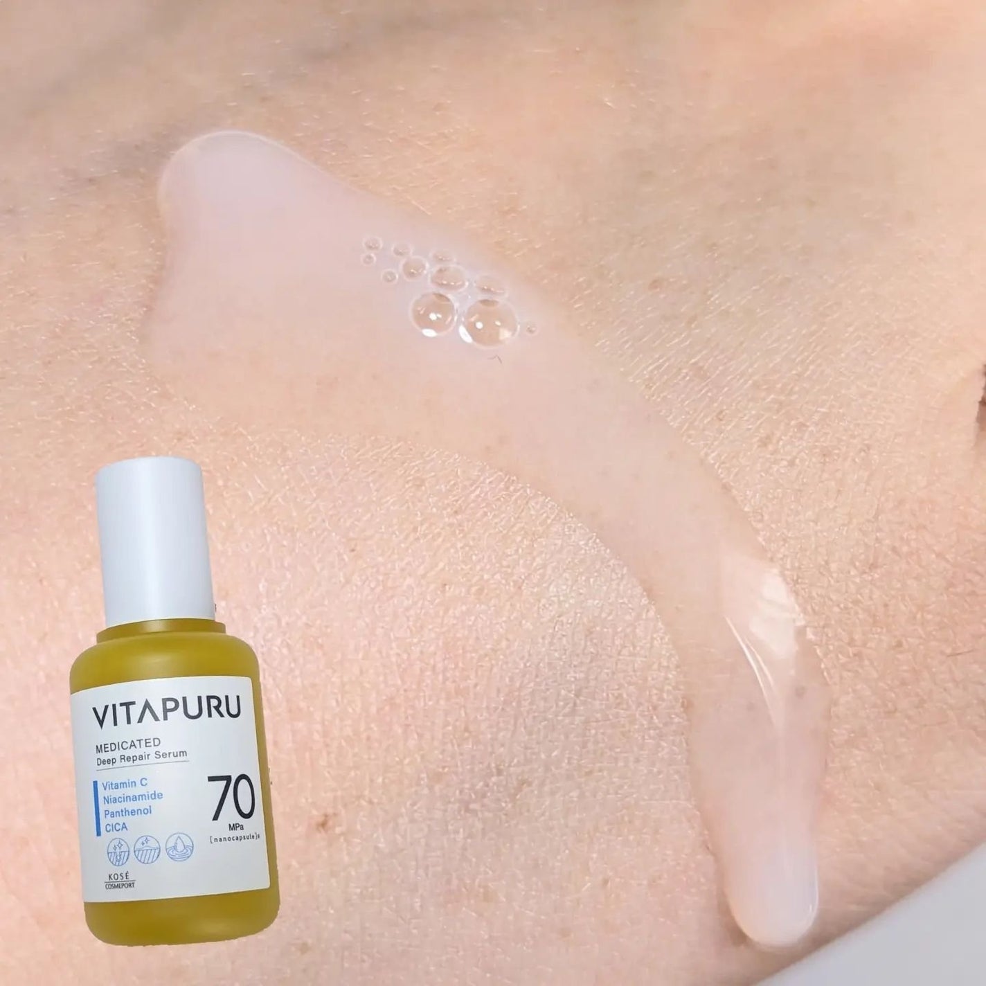 ビタプル リペア エッセンスローション/VITAPURU/化粧水を使ったクチコミ(2枚目)