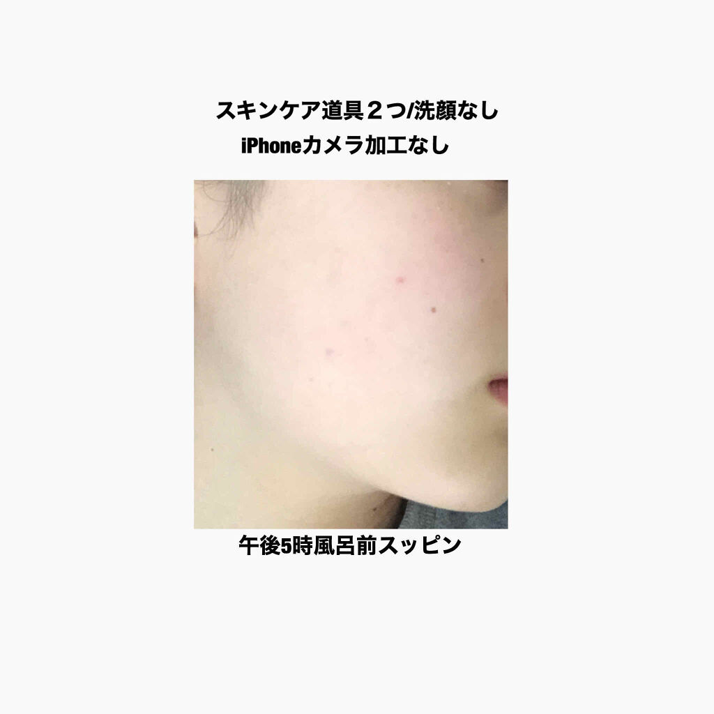 ハトムギエキス化粧水/プラチナレーベル/化粧水を使ったクチコミ（1枚目）