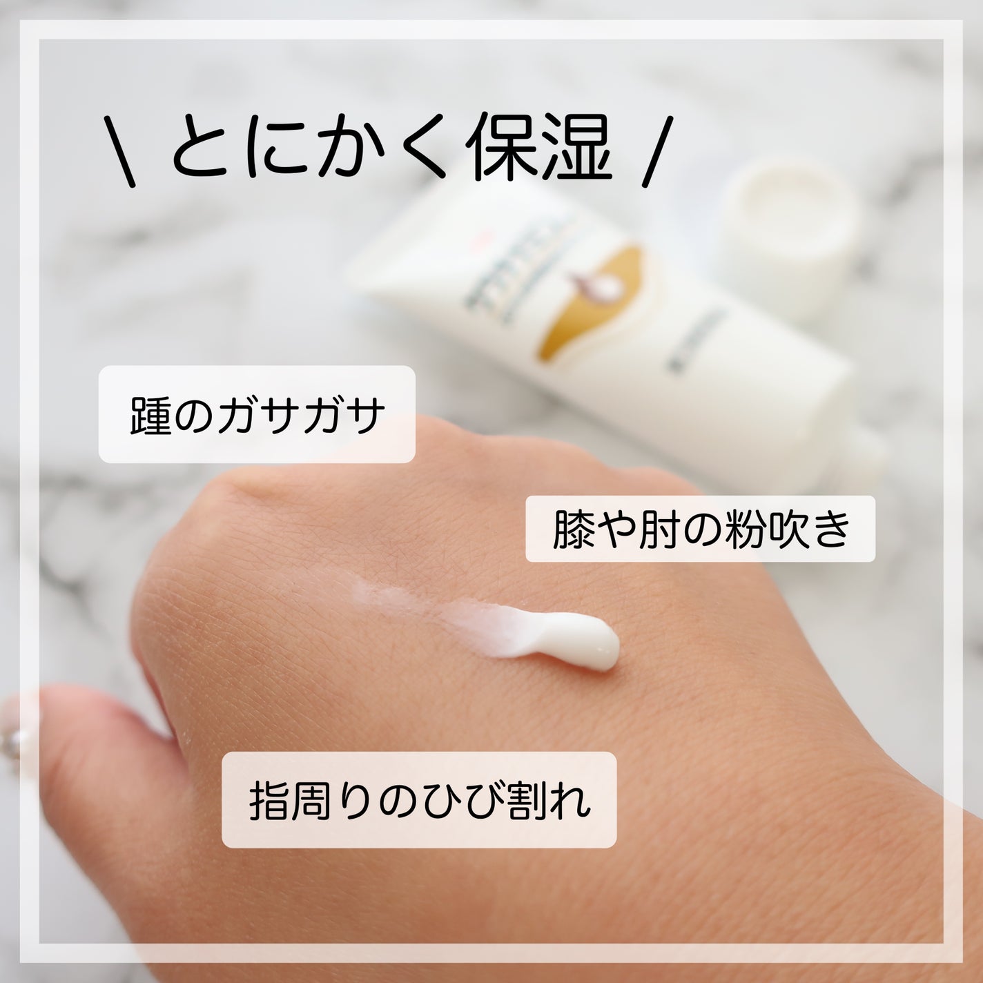 コーワ20%尿素配合クリーム(医薬品)/ケラチナミン/その他を使ったクチコミ(2枚目)