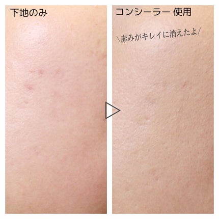 カバーパーフェクション チップコンシーラー/the SAEM/リキッドコンシーラーを使ったクチコミ(3枚目)