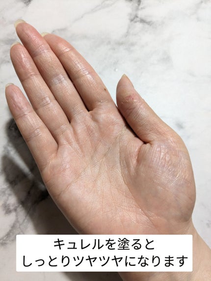 潤浸保湿 化粧水 III とてもしっとり/キュレル/化粧水を使ったクチコミ(4枚目)