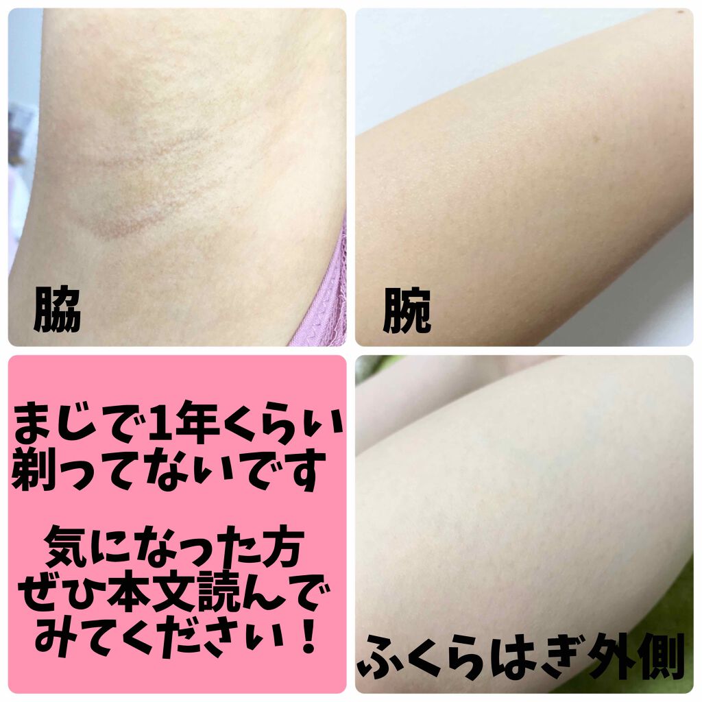 光美容器KE-NON(ケノン)/エムテック/家庭用脱毛器を使ったクチコミ(2枚目)