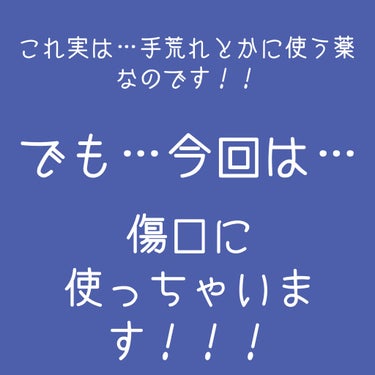 フェルゼアHA20クリーム（医薬品）/フェルゼア/その他を使ったクチコミ（3枚目）