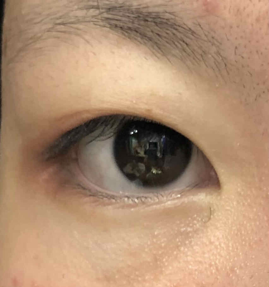 ストリングファイバー120 ディープタイプ/メザイク/二重まぶた用アイテムを使ったクチコミ（2枚目）