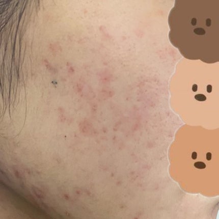 colza on LIPS 「-肌日記230227-2月中旬ぐらいから食欲が一気になくなって..」(6枚目)