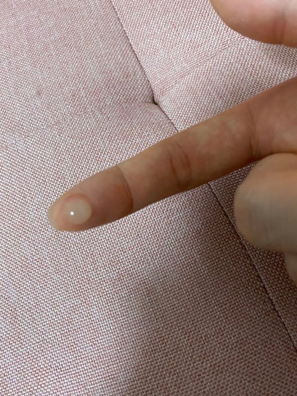 ニキビあとケアジェル/アットノン/その他スキンケアを使ったクチコミ(4枚目)