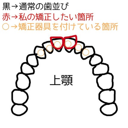 ブレスファイン マウススプレー/オーラツー/マウスウォッシュ・スプレーを使ったクチコミ(2枚目)