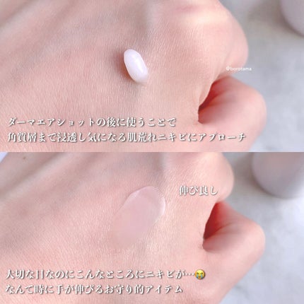 スーパーシカクイックマスクパック/MEDICUBE/シートマスク・パックを使ったクチコミ(10枚目)