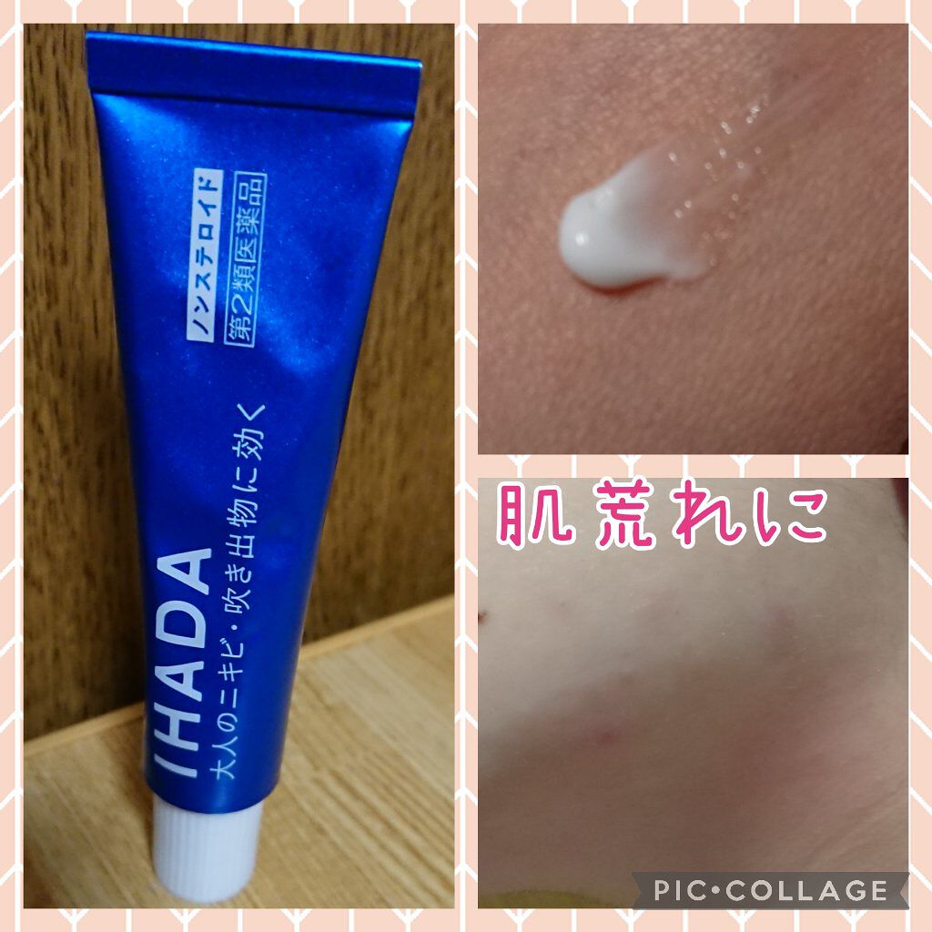アクネキュアクリーム(医薬品)/IHADA/その他を使ったクチコミ(1枚目)