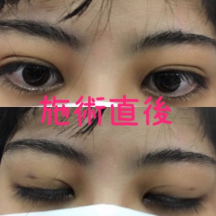äºéæŽåœ¢/ãã®ä»ã䜿ã£ãã¯ãã³ãïŒ2æç®ïŒ