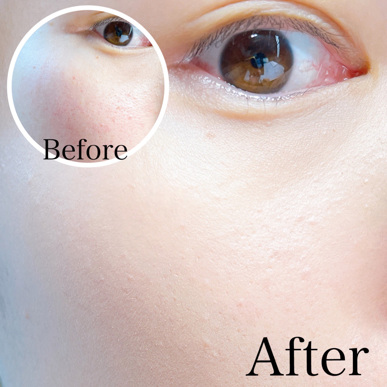 ミネラルカバーBBクリームN/CEZANNE/ファンデーションを使ったクチコミ（3枚目）