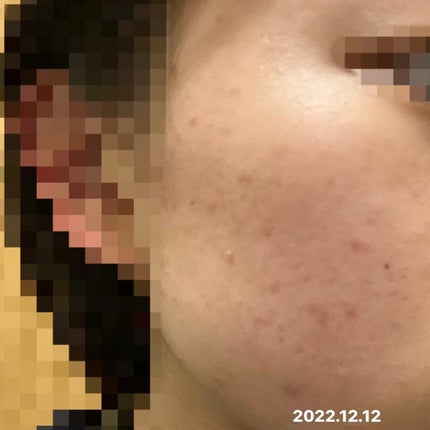 マイルドクレンジング オイル/ファンケル/オイルクレンジングを使ったクチコミ(4枚目)