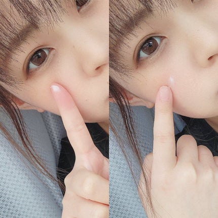 モイスチュア バーム/カルテHD/フェイスバームを使ったクチコミ(5枚目)