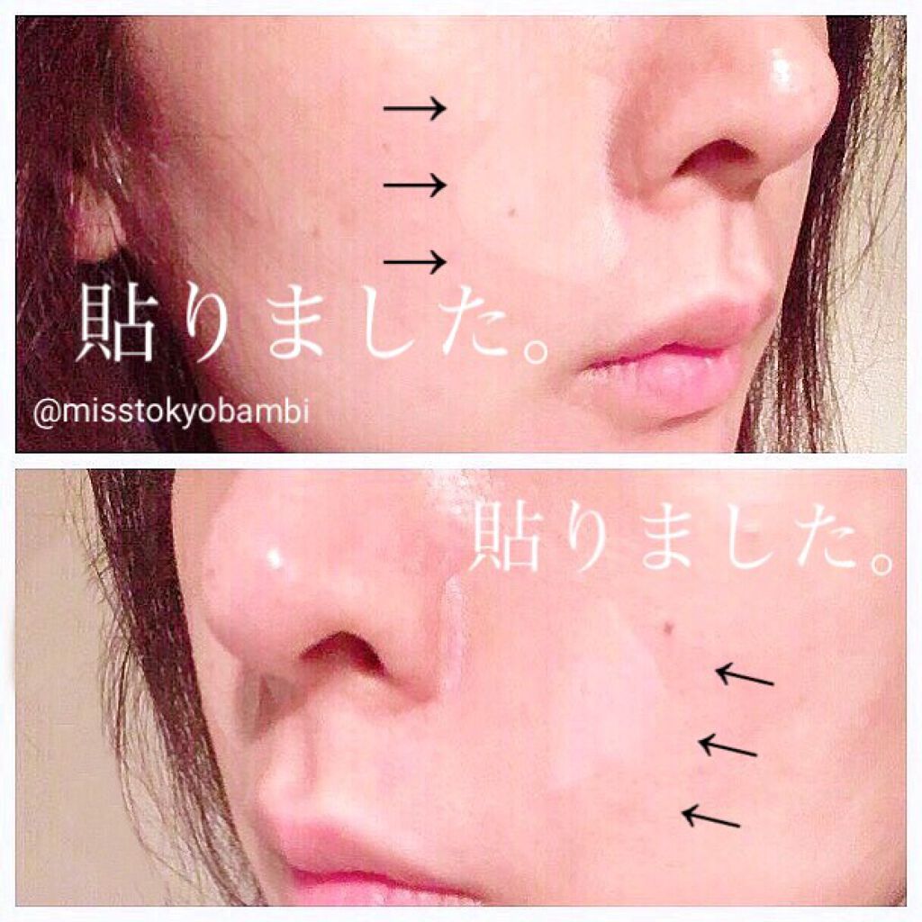 試してみた】おやすみ中のしわ伸ばしテープ/MAGIE LAB | LIPS 試してみた】おやすみ中のしわ伸ばしテープ/MAGIE LAB | LIPS