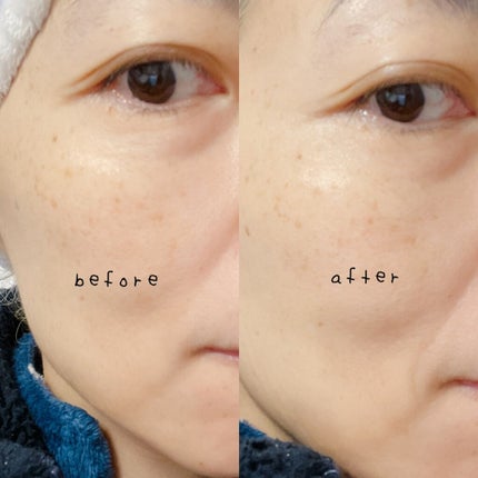 リフトホワイト パーフェクション/BRIGHTAGE/美容液を使ったクチコミ(4枚目)