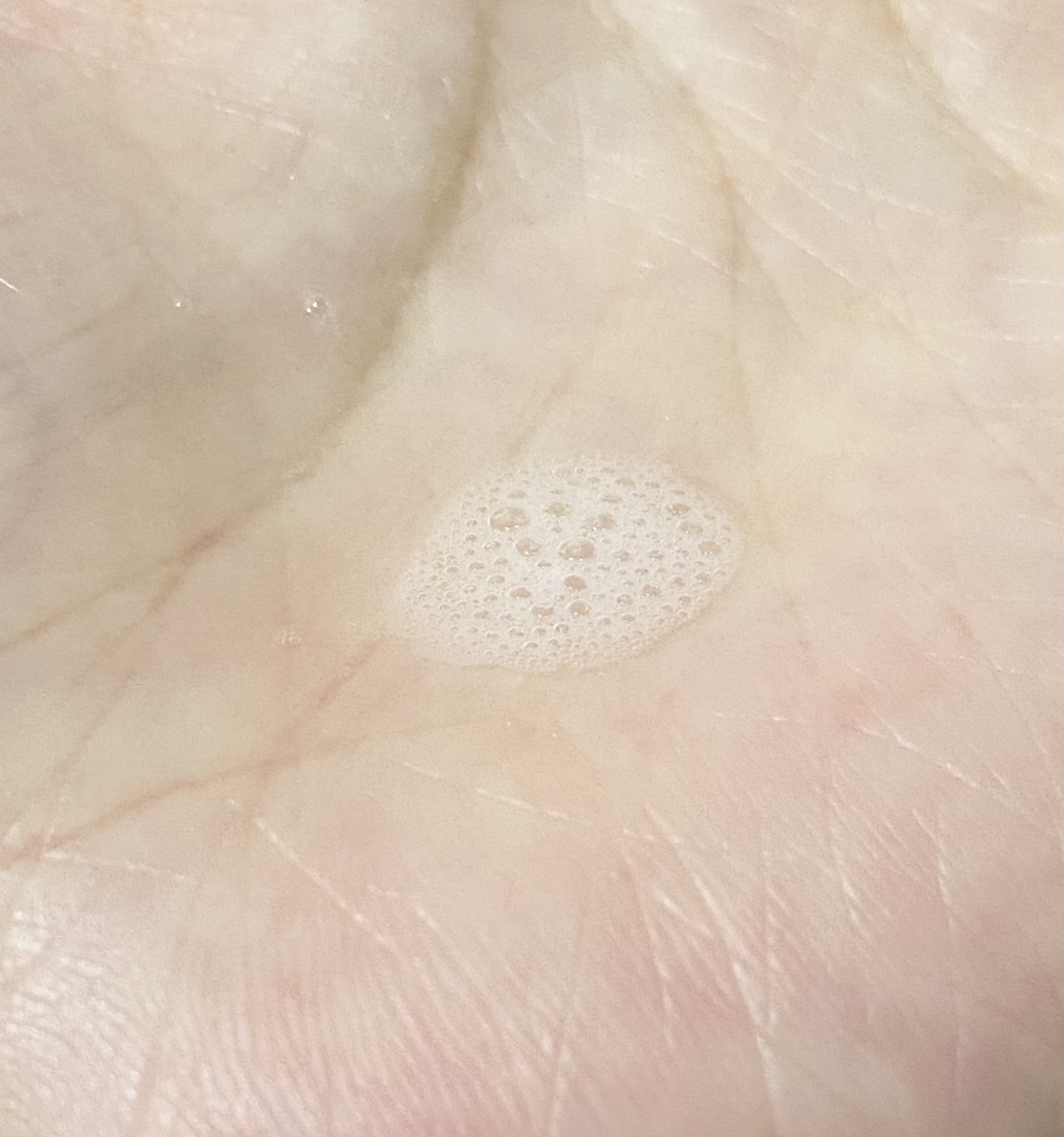 CICAケア ボディミスト/someblossom/ミスト状化粧水を使ったクチコミ（2枚目）