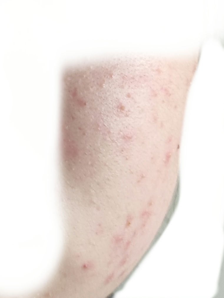 日 記 帳 on LIPS 「つらい!でもこれがデフォルトだからつらいというよりは諦め寄りで..」(4枚目)