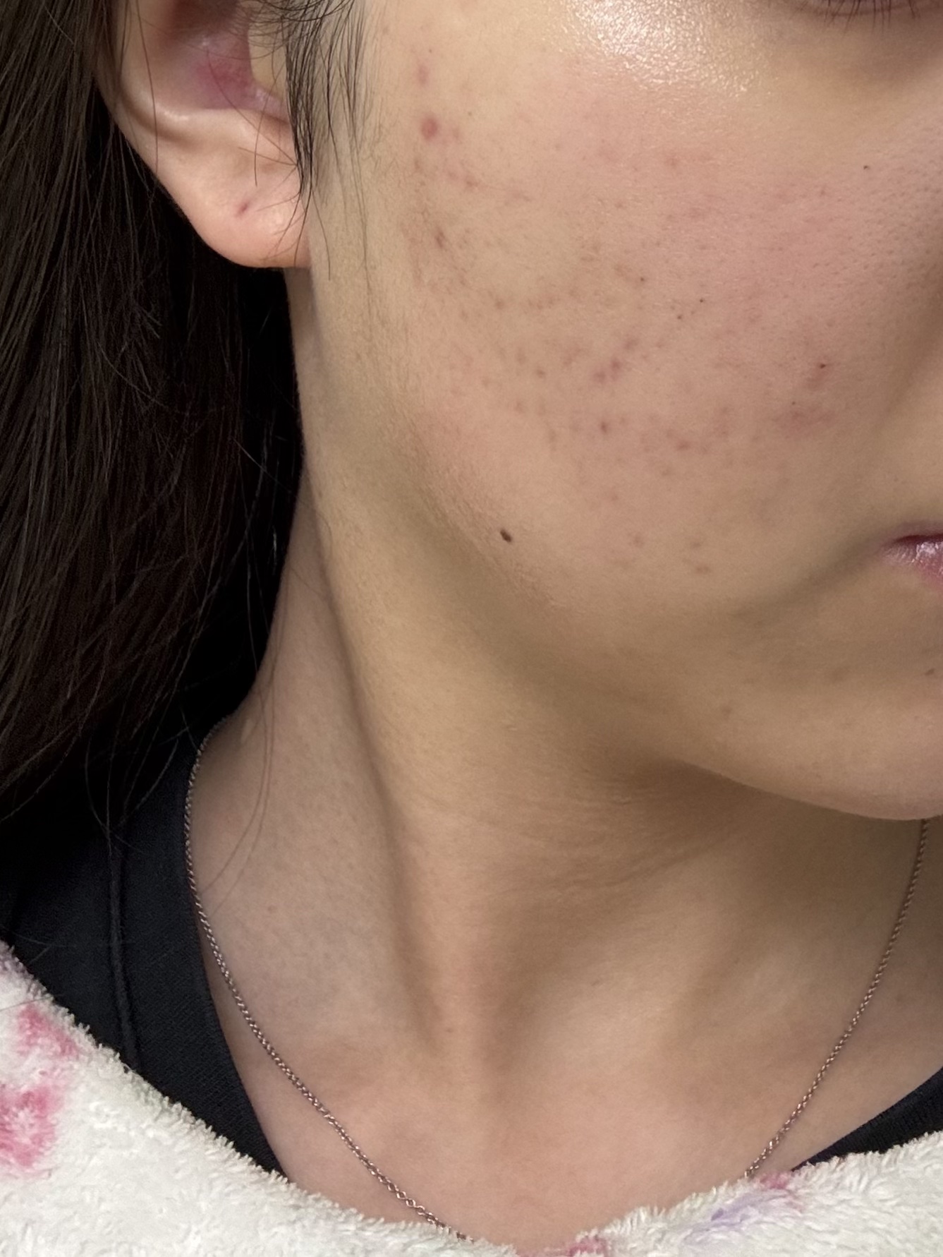 浸透湿潤セラミド１０％★ナノエマルジョン/TOUT VERT/乳液を使ったクチコミ（1枚目）