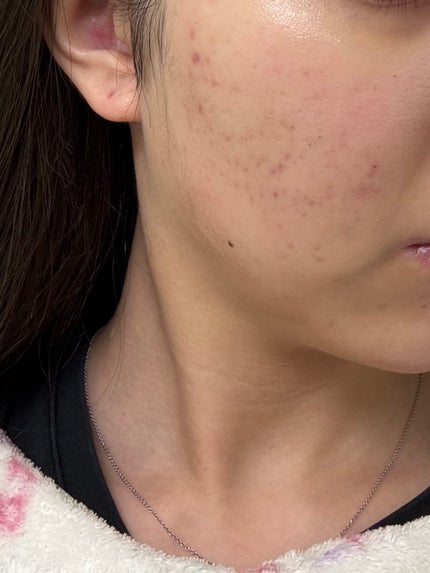 浸透湿潤セラミド10%★ナノエマルジョン/TOUT VERT/乳液を使ったクチコミ(1枚目)