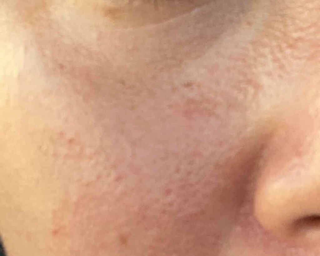 ハトムギ化粧水(ナチュリエ スキンコンディショナー R )/ナチュリエ/化粧水を使ったクチコミ（1枚目）