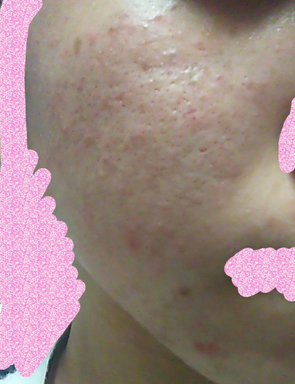 らん on LIPS 「すみません、クチコミではないんですけど…肌日記をつけようと思い..」(3枚目)