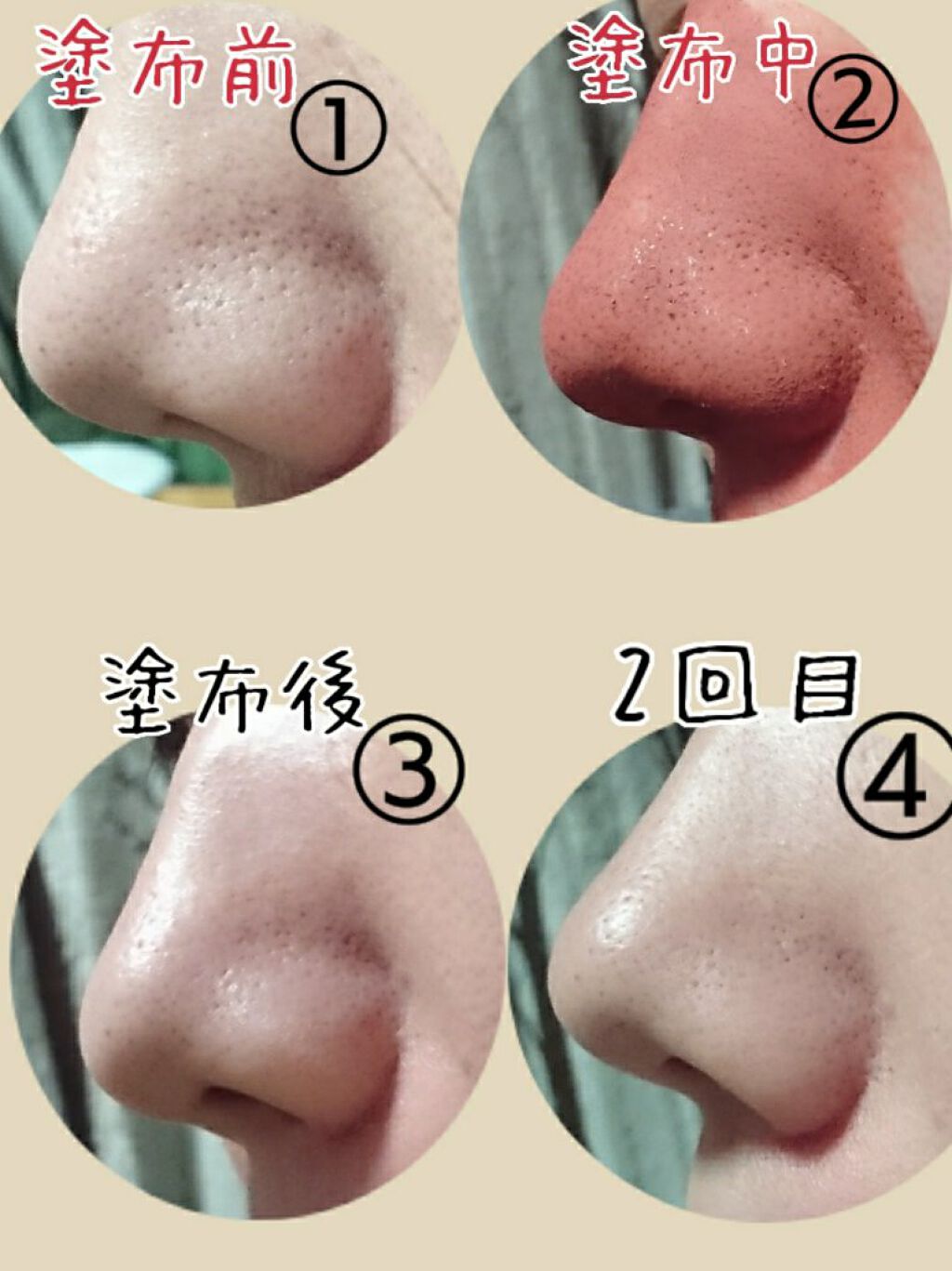 ガスールパック レッドプラス/ツルリ/洗い流すパック・マスクを使ったクチコミ（3枚目）