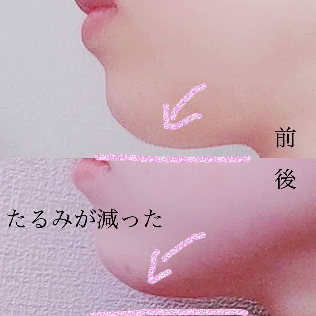 ミノン アミノモイスト モイストチャージ ミルク/ミノン/乳液を使ったクチコミ(2枚目)