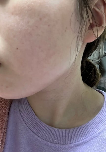 明色美顔水 薬用化粧水/美顔/化粧水を使ったクチコミ(3枚目)