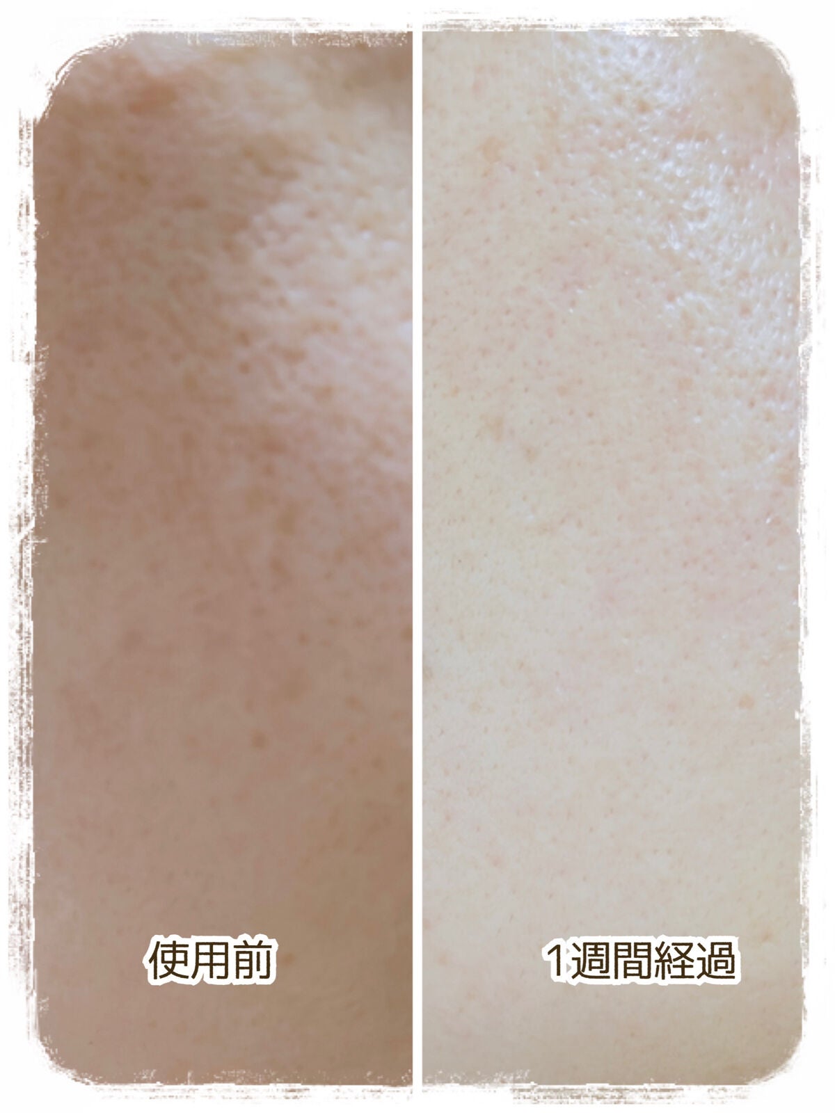 Lucrezia Serum(ルクレツィア セラム)/fearless/美容液を使ったクチコミ(4枚目)