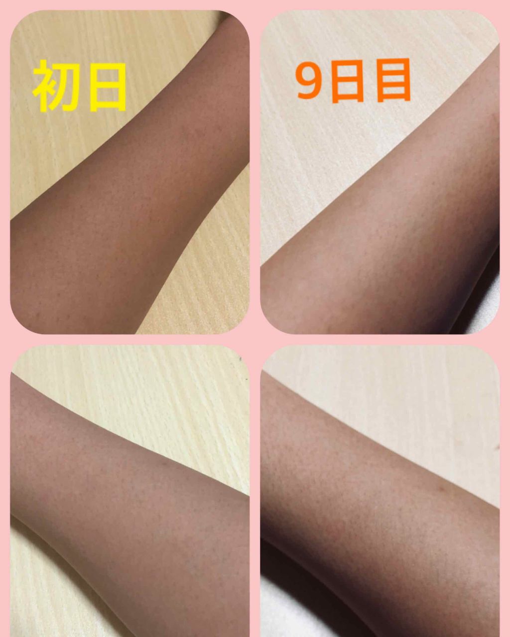 DHC はとむぎエキス/DHC/健康サプリメントを使ったクチコミ（1枚目）