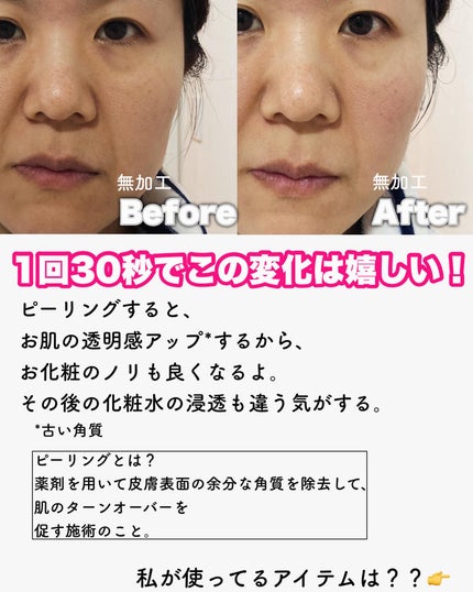 ロゼットゴマージュ/ロゼット/ピーリングを使ったクチコミ(2枚目)