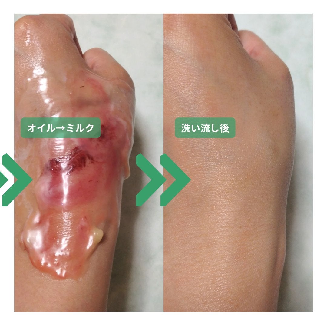 グリーンディープポアクレンジングバーム/Dr.G/クレンジングバームを使ったクチコミ(6枚目)