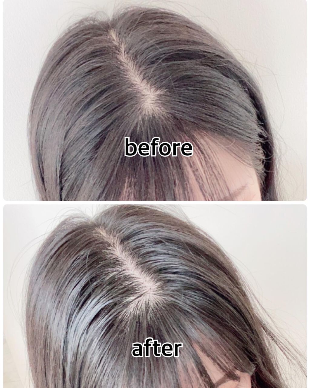 メディカルスカルプスパエッセンス/ティアレラプラス/頭皮ローションを使ったクチコミ（3枚目）